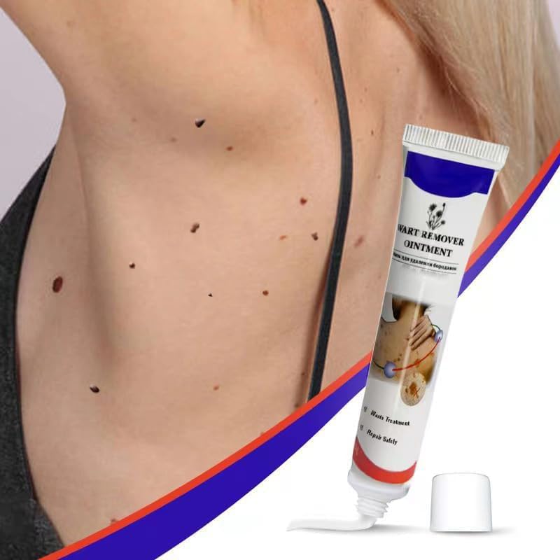Warts Remover ointment